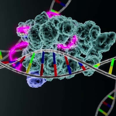 One CRISPR Infusion Cuts Dangerous Cholesterol for a Year in Early Human Trial