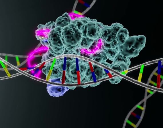 One CRISPR Infusion Cuts Dangerous Cholesterol for a Year in Early Human Trial